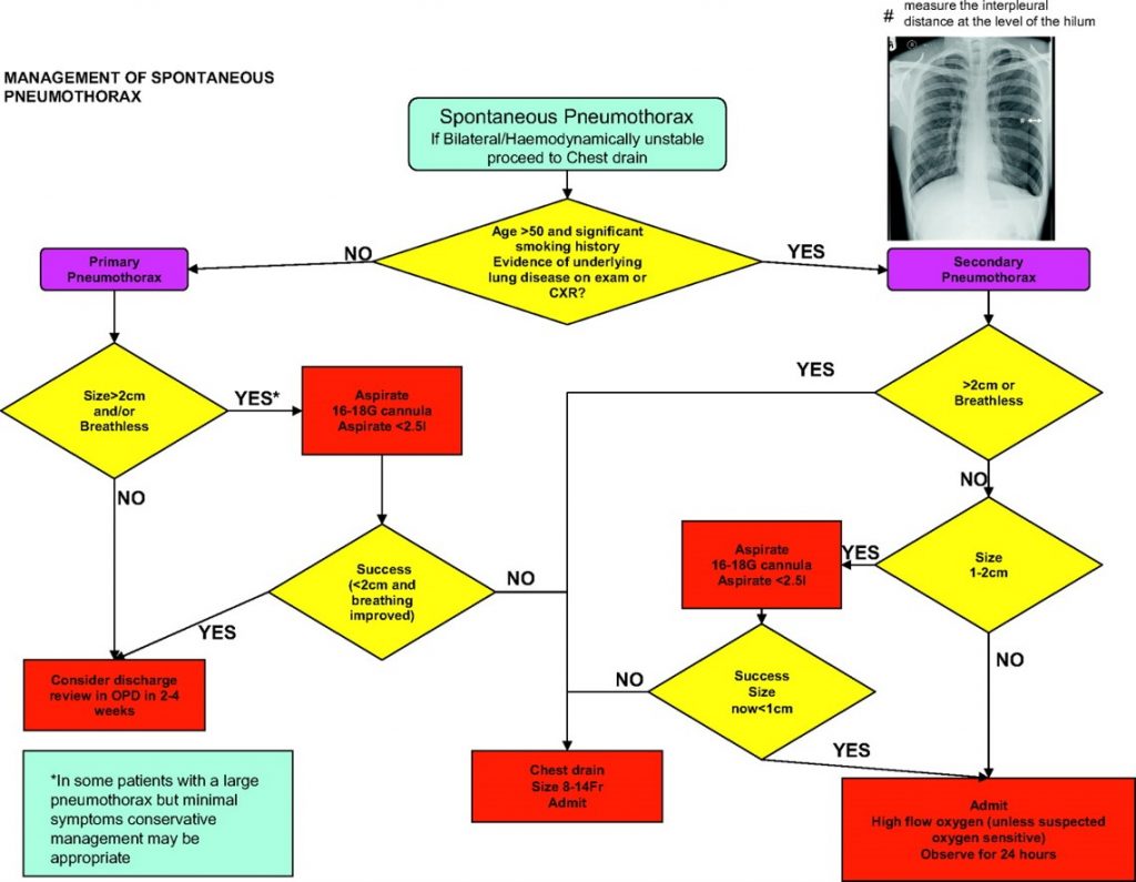 pathophysiology of pneumothorax flowchart